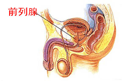 急性前列腺炎是怎么得的